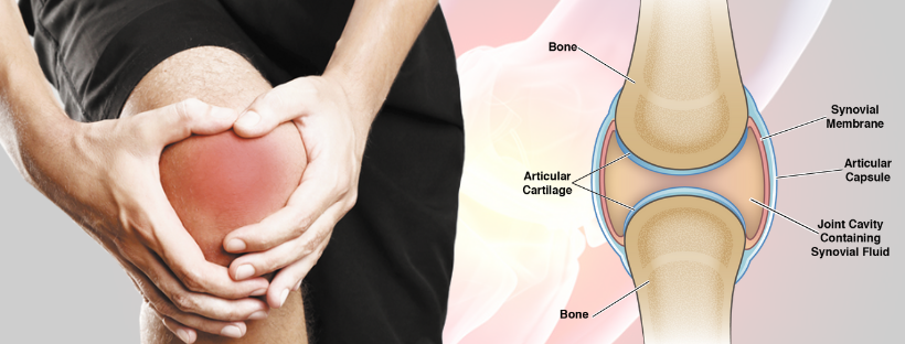 Knee Arthritis- The Major Reason for Knee Replacement Surgery