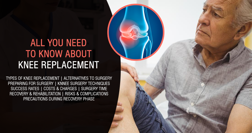 All You Need to Know About Knee Joint Replacement Surgery